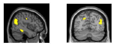 Neuroimagem